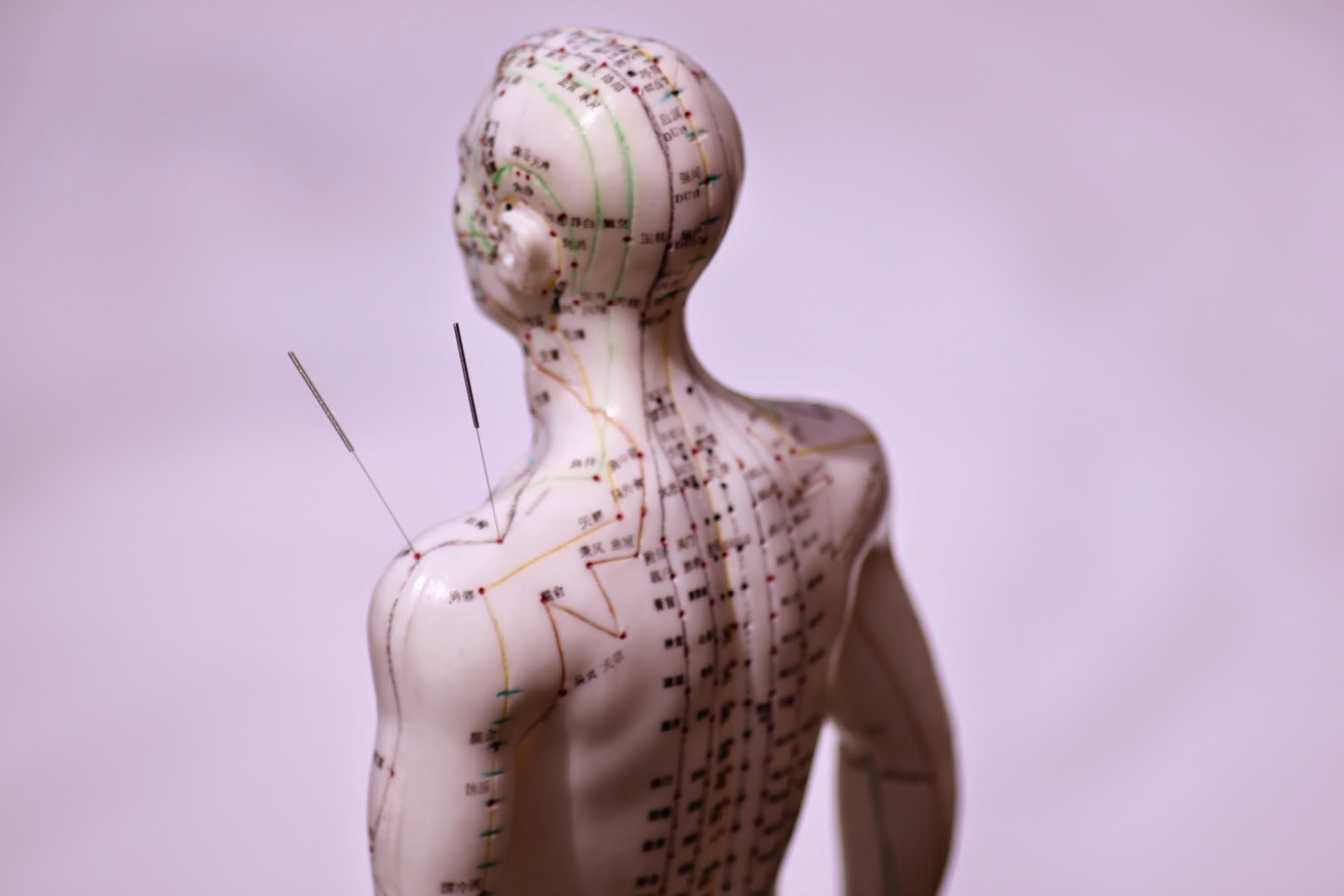 Acupuncture Plus