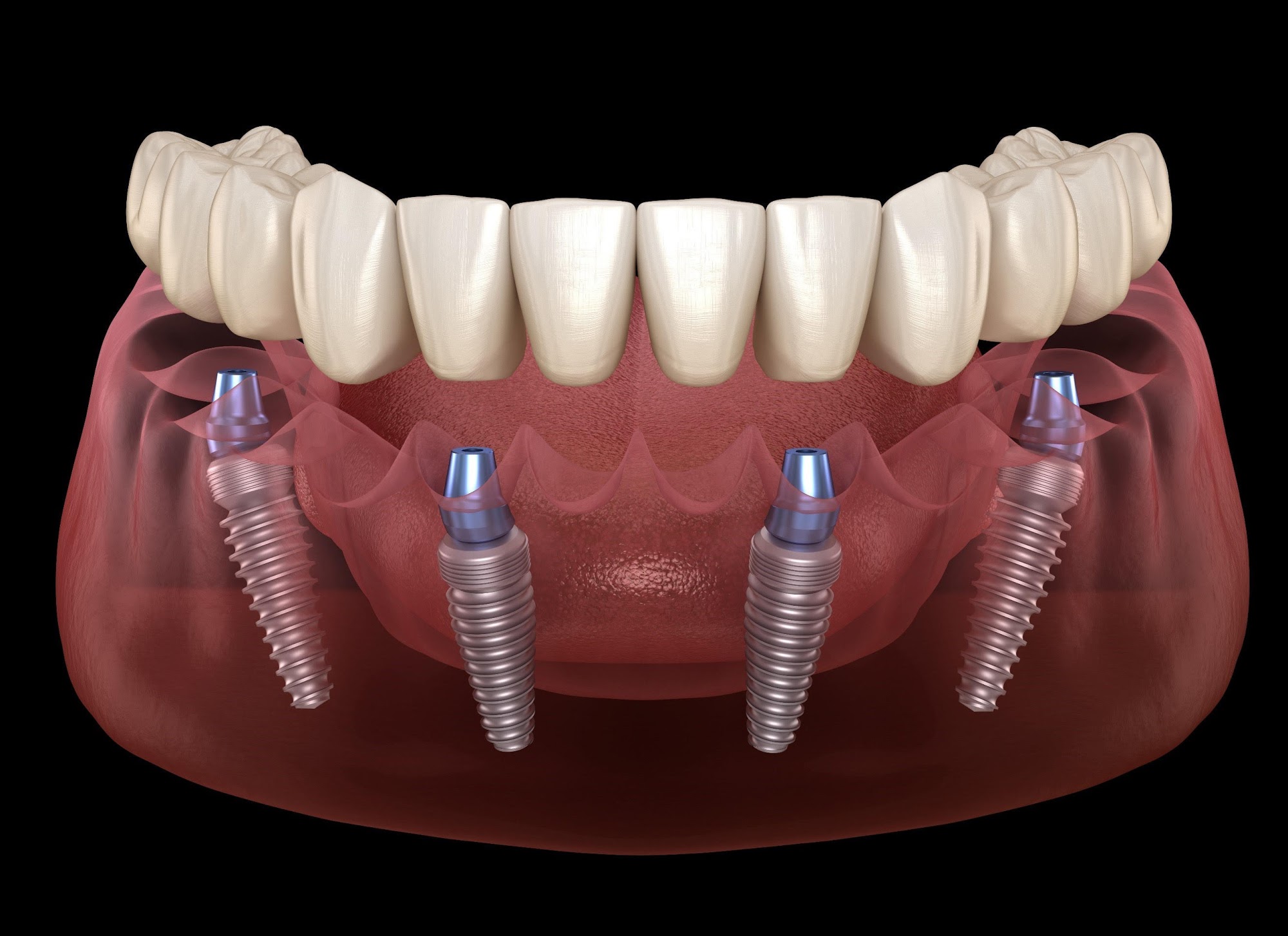 La Costa Family Dental and Implant Center