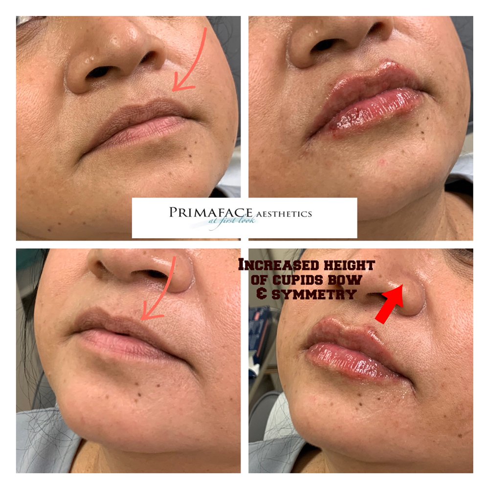 Photo credit: 