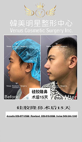Venus Cosmetic Surgery Inc.