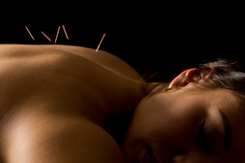 Emily Smith Acupuncture