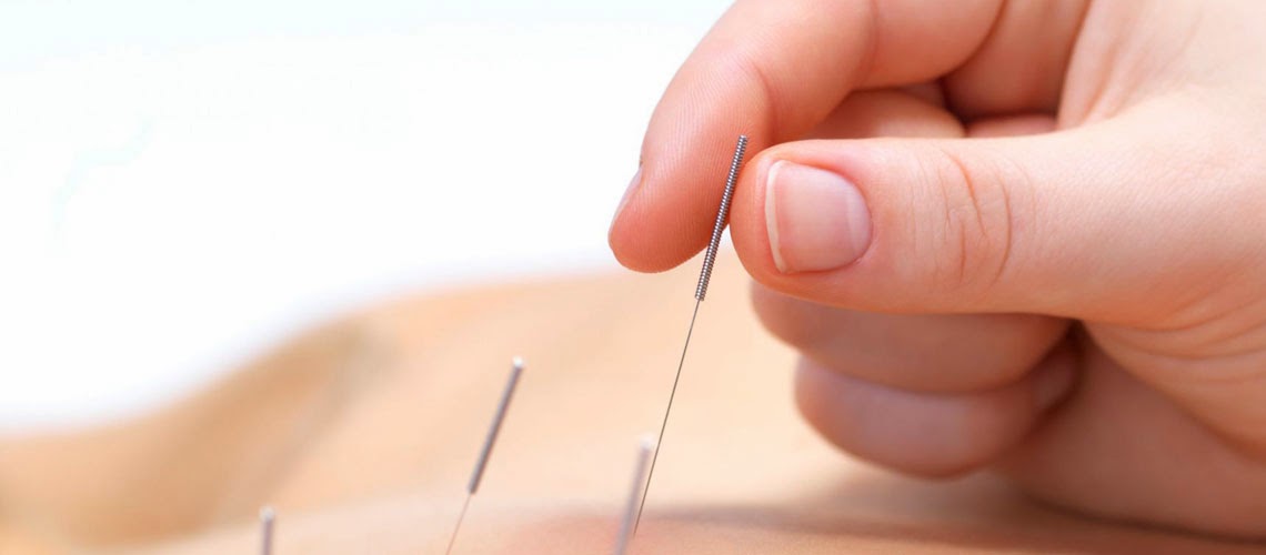 Premier acupuncture care