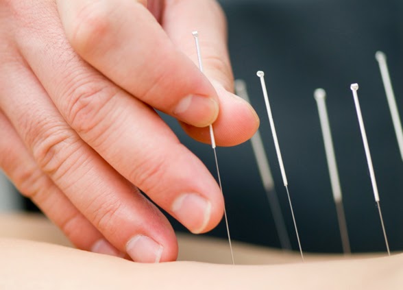 Natural Living Chiropractic & Acupuncture