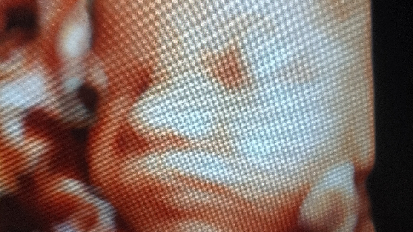 Sweet Baby Face hd 3d 4d ultrasound in Elizabethtown KY
