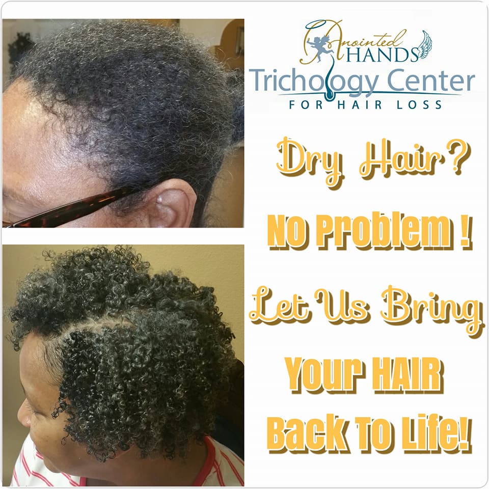 anointed hands trichology center for hair loss