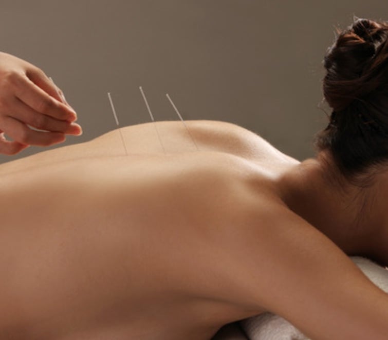 Caroline Berry Acupuncture