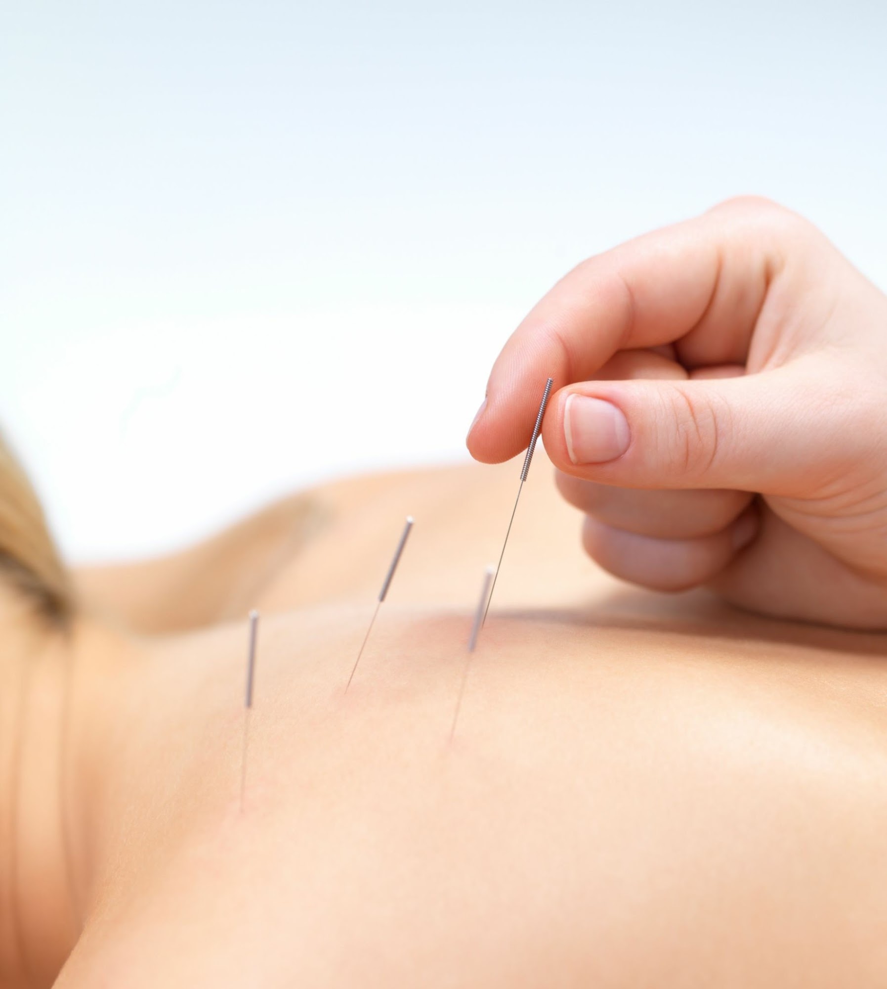 Point and Balance Acupuncture & Massage
