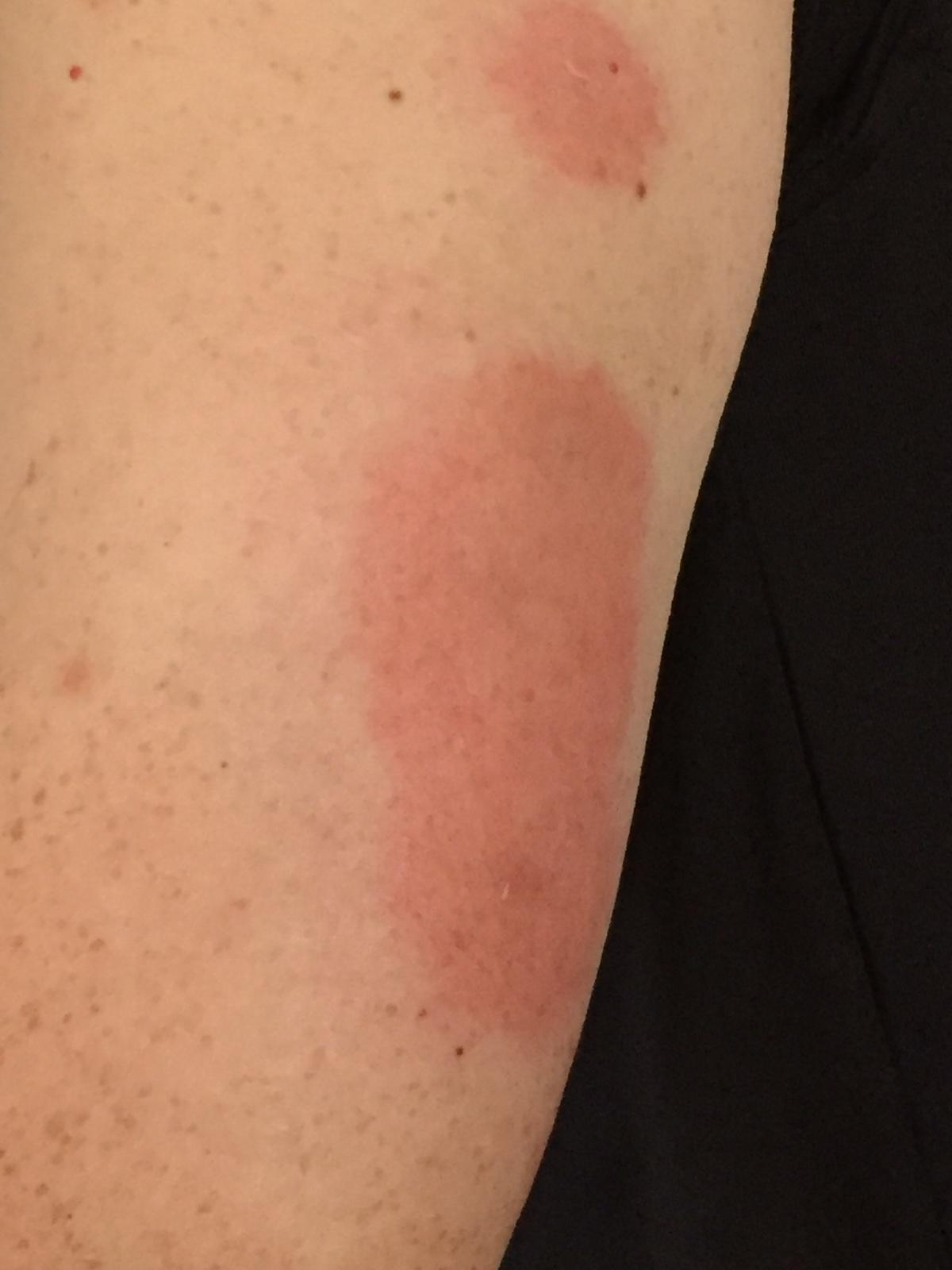 Photo credit: homestars