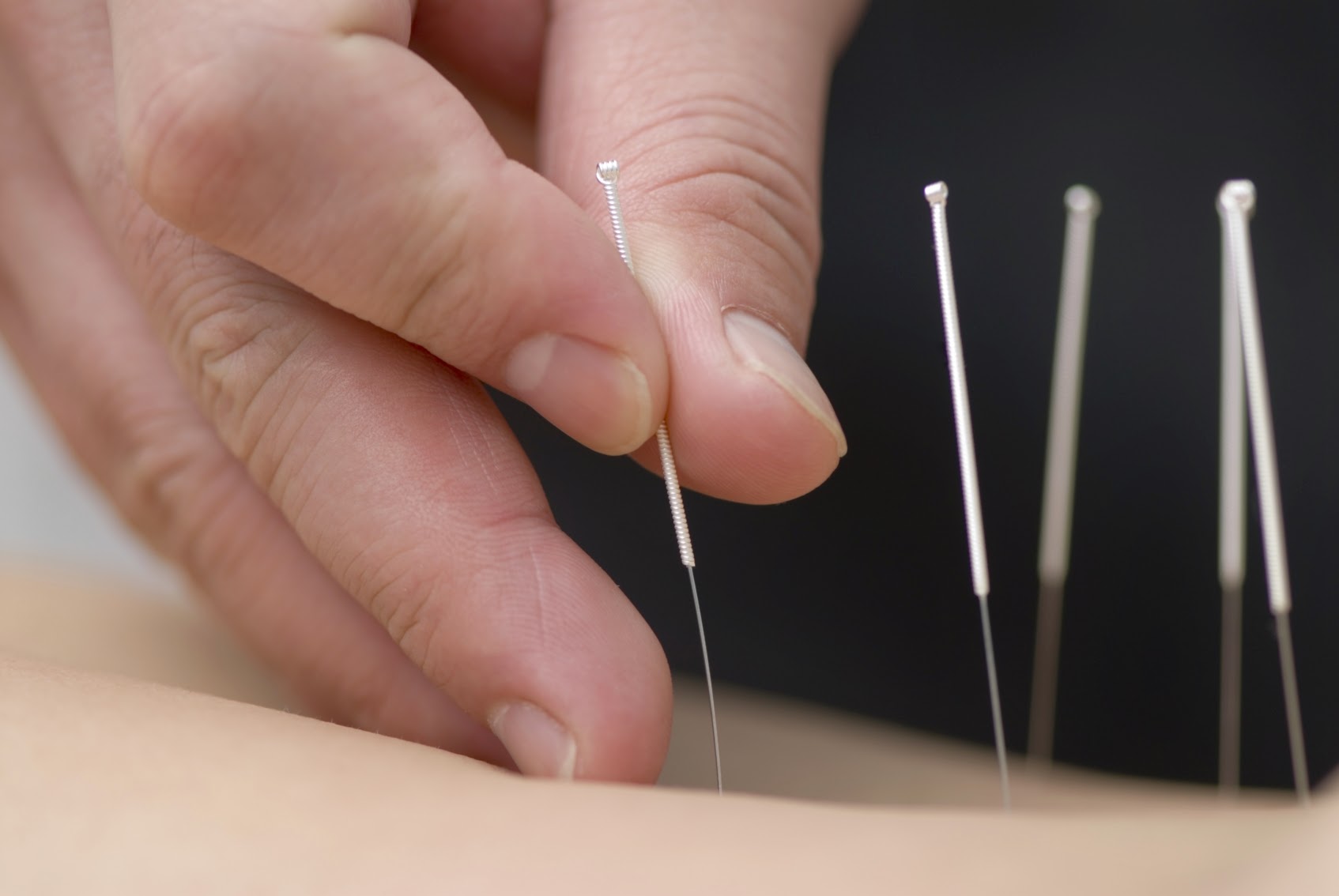 Richmond Hill Acupuncture and Natural Therapy Clinic