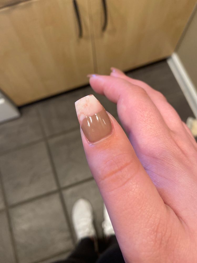 A nails