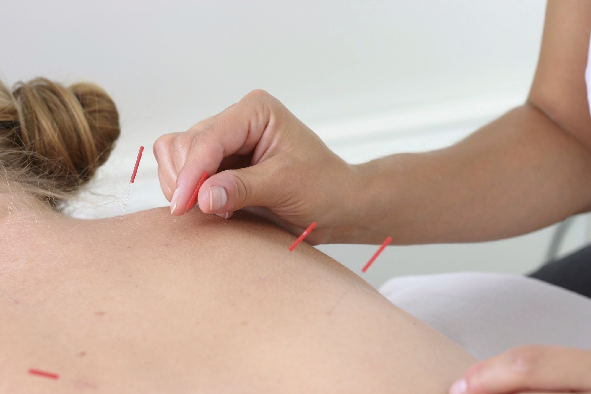 Bucks County Acupuncture Clinic