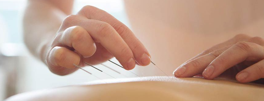 Medical Acupuncture of Chester County