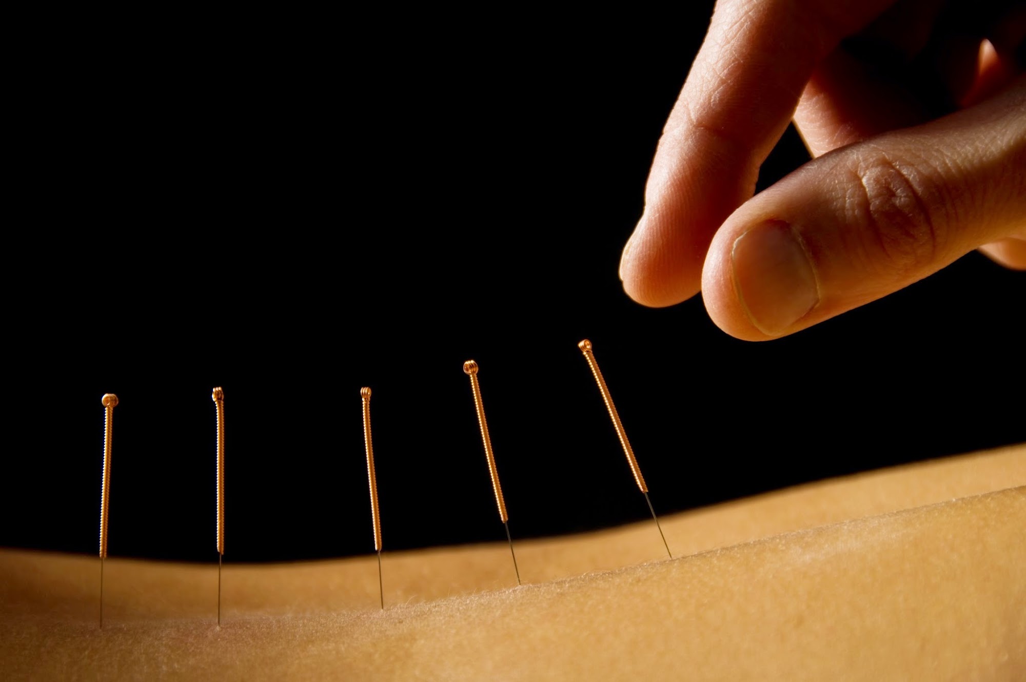 HealthWorks Physiotherapy Massage Therapy & Acupuncture