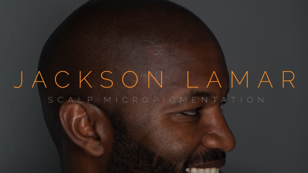 Jackson Lamar Scalp Micropigmentation