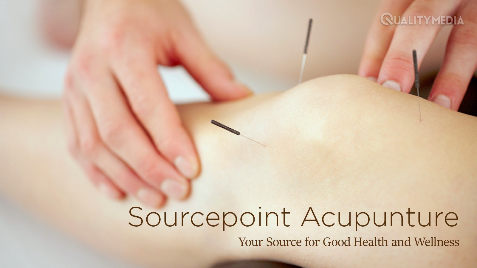 Sourcepoint Acupuncture
